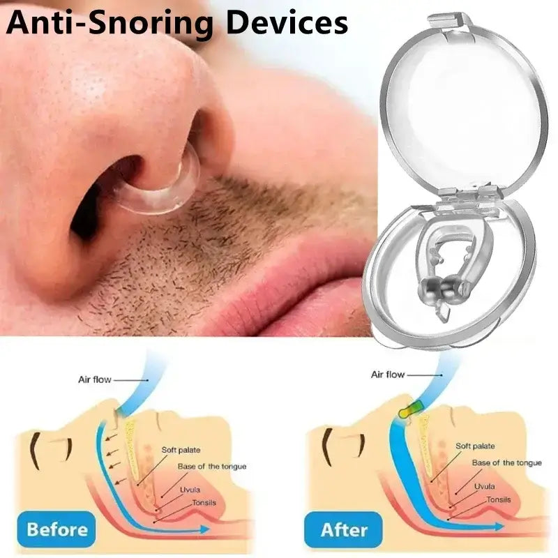 Anti-Snoring Nose Clip – Sleep Aid Snore Stopper Device for Men & Women